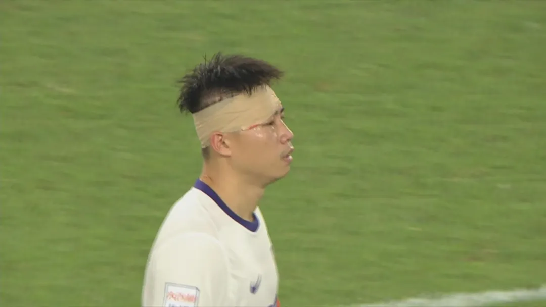 天博-津媒：杨帆右眼眉骨受伤赛后缝针，王献钧两颗门牙直接被撞断